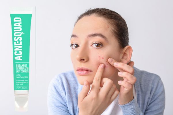 Surprising Causes of Adult Acne and How to Get Rid of It