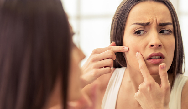 These 5 common mistakes can cause acne