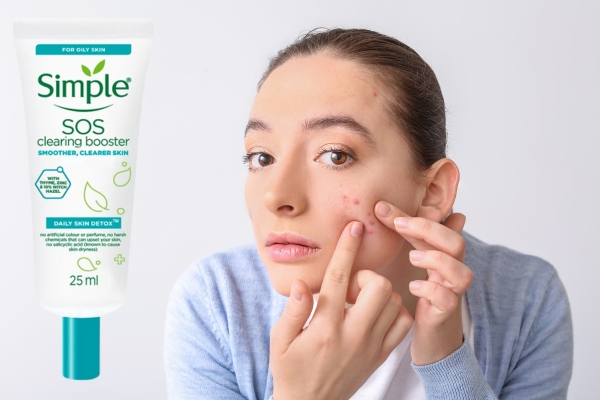 Tips on How to Get Rid of a Pimple Before a Big Event