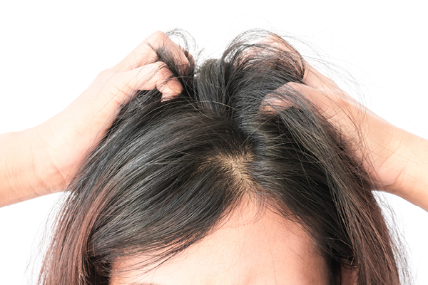 FAQs to get rid of head lice