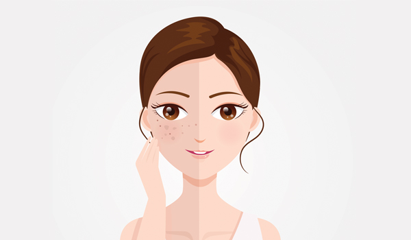 8 effective home remedies for face pigmentation