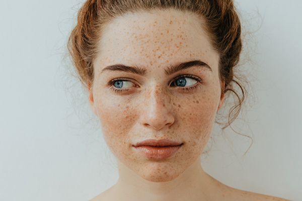 Home remedies for freckles 9: Eggplant for freckles
