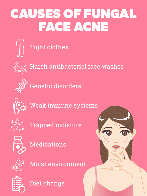 How to treat fungal face acne?