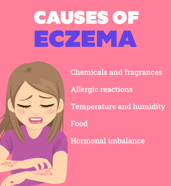 An expert reveals everything you need to know about eczema treatments