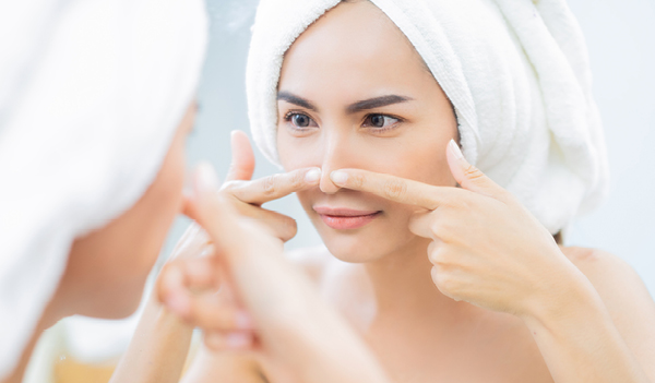 The Best Solution to Prevent and Remove Blackheads: Top 5 Tips 
