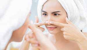 The Best Solution to Prevent and Remove Blackheads: Top 5 Tips 