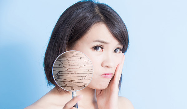 5 surprising causes of dry skin