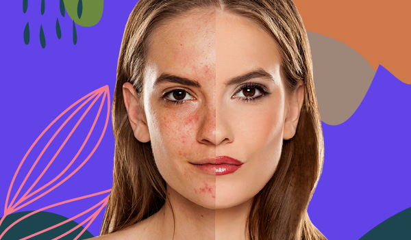 How to cover blemishes with makeup in 5 simple steps 