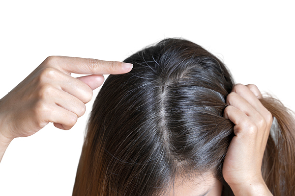 How to Consume Folic Acid for Hair?