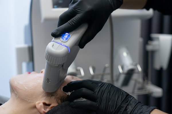 High Intensity Focused Ultrasound Facials Are Non-Invasive