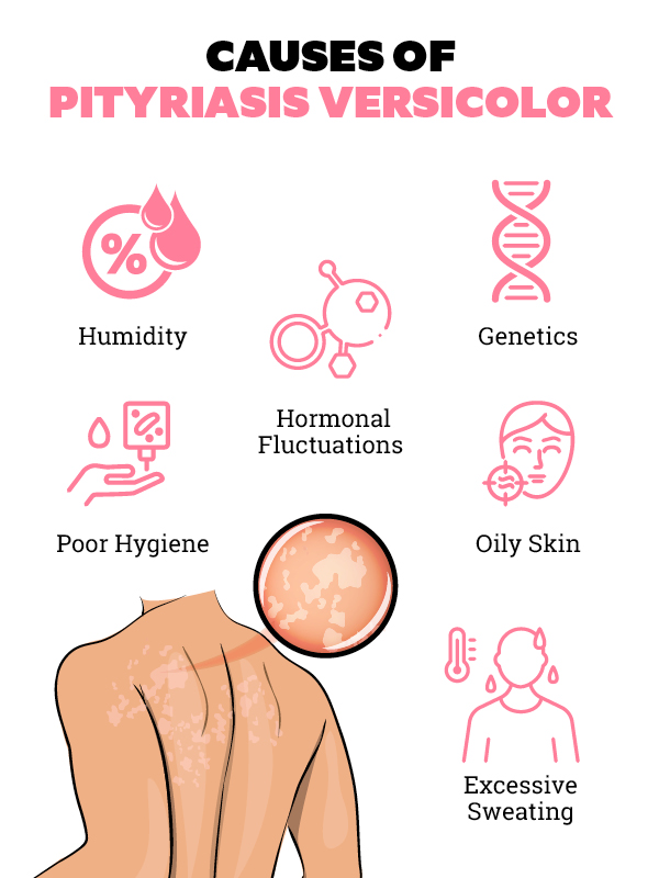 Everything You Need To Know About Pityriasis Versicolor