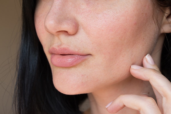 How do you deal with pores?