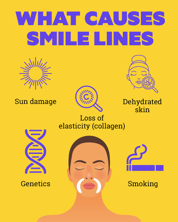 How to Get Rid of Laugh and Smile Lines: 5 Expert Tips