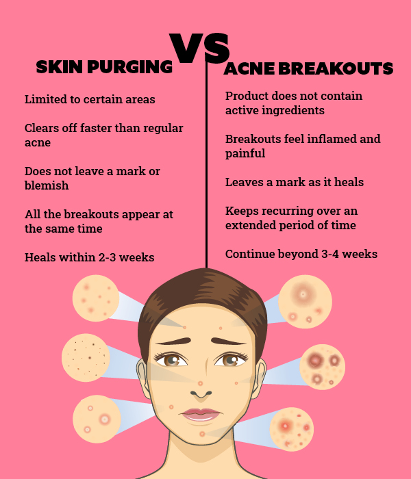 How long does skin purging last?