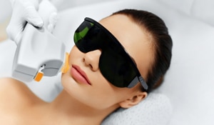 Everything you need to know about Facial Laser Treatment