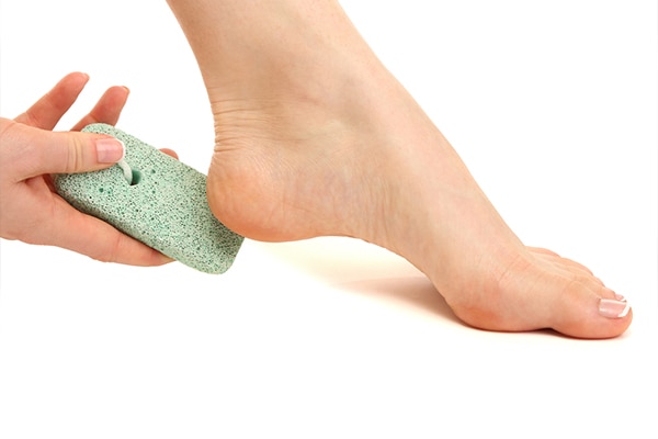 What Really Causes Cracked Heels and How to Heal Them (Part I) - Century  Medical & Dental Center