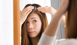 Here's How To Get Rid Of an Itchy Scalp And Dandruff