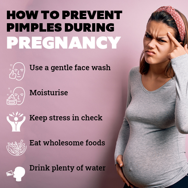 An Expert’s Guide On Safely Treating Pimples During Pregnancy