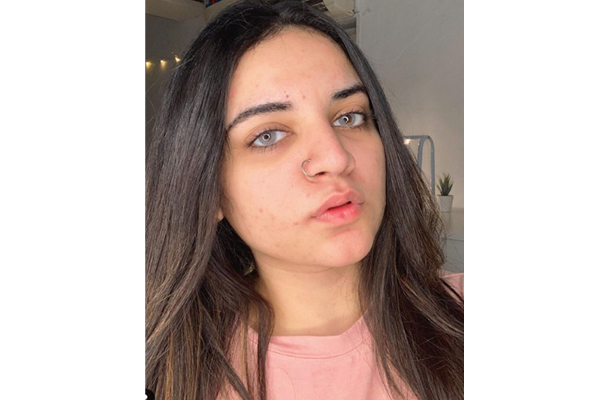 BB exclusive: Indian influencer Prableen Kaur on her journey towards self-love and acceptance with acne and PCOS