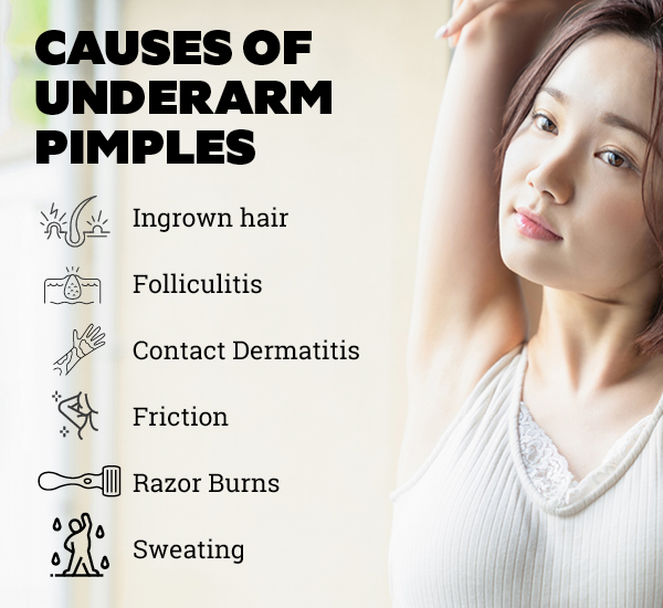 Pimples store under armpit