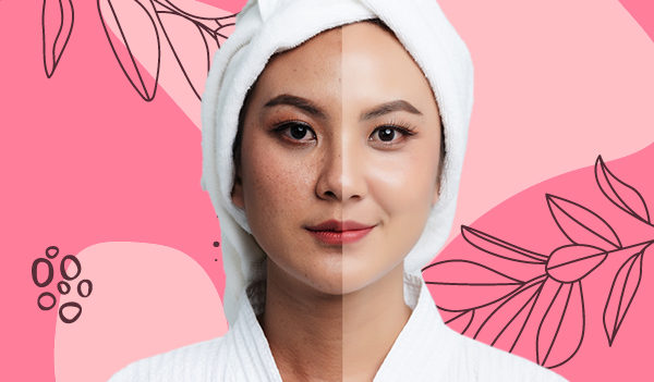 This is the only skincare routine you need to follow to get rid of dark spots