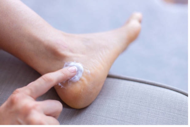 10 Incredible Natural Remedies For Cracked Heels