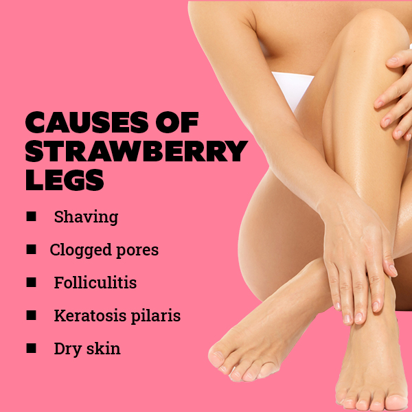 We bet you didn t know of these treatments for strawberry legs