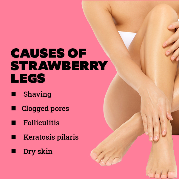 FAQs about strawberry legs