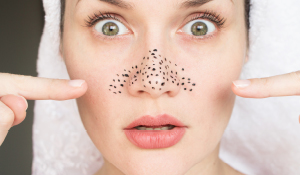 Say Goodbye To Blackheads With These 9 Homemade Face Scrubs!