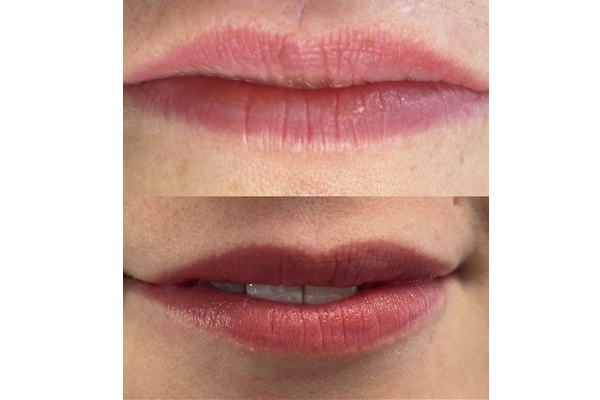 Stunning Lip Blush Transformation