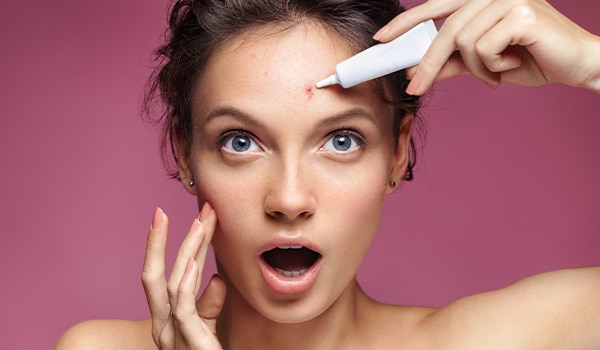 Your acne treatment could be making your skin sensitive! Know how you can deal with it  