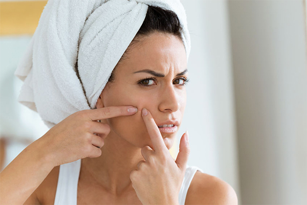 4 common skin concerns that can be treated using benzoyl peroxide