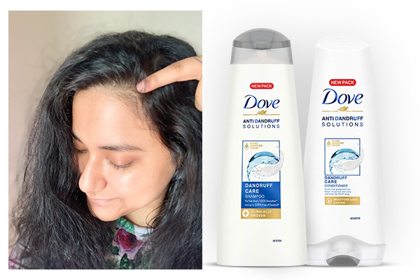 dove dandruff care shampoo and conditioner review