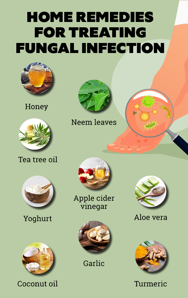 Know the best way to cure Jock Itch, Home remedies and treatment