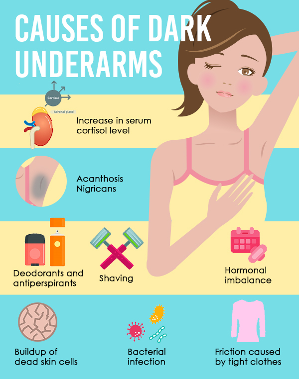 How to get rid of dark underarms: causes and remedies