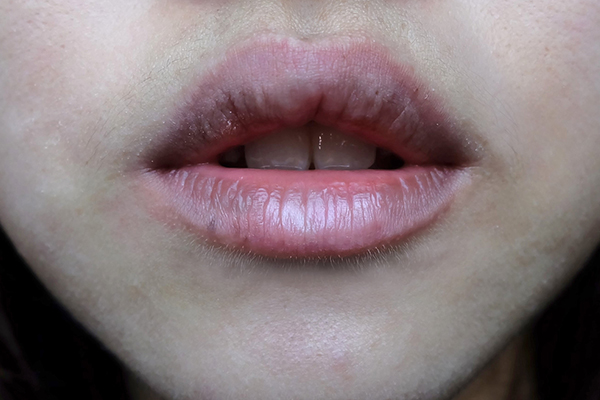 FAQs related to lighten dark lips