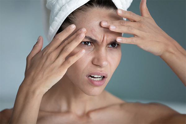 Got red spots on your skin? Here are 9 natural ways to deal with them