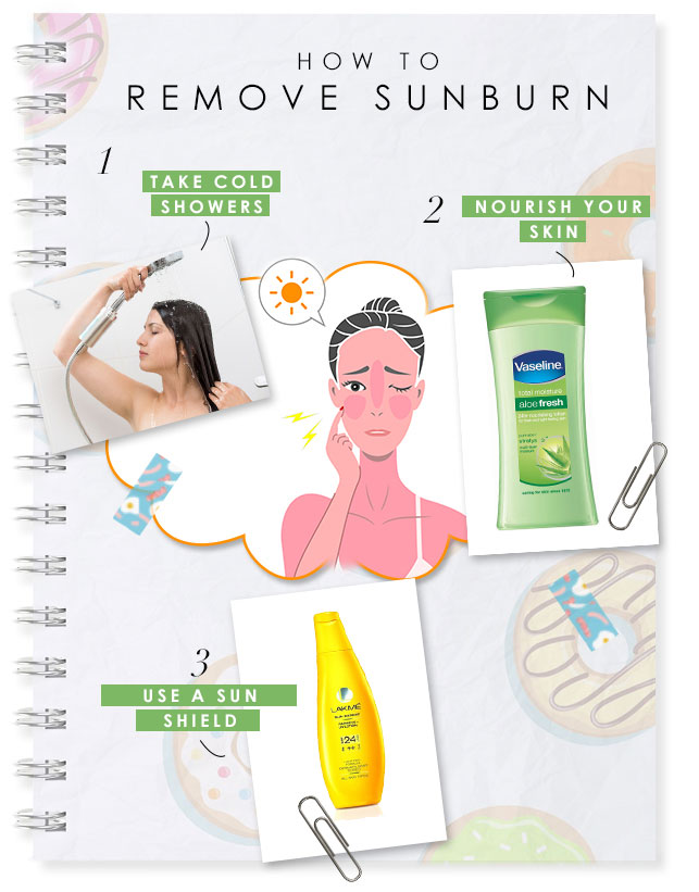 How to remove sunburn