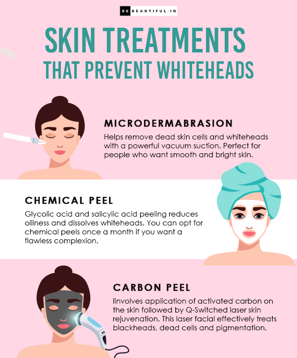 Wondering How To Remove Whiteheads? These Tried And Tested Tips Will Help