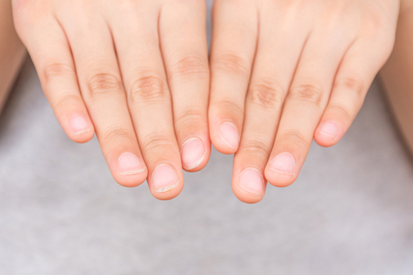 How to Care for Natural Nails After Acrylics