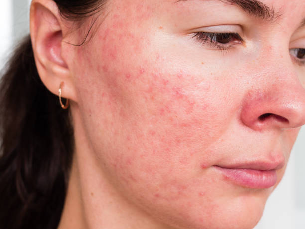 Common Skin Problems and How to Treat Them