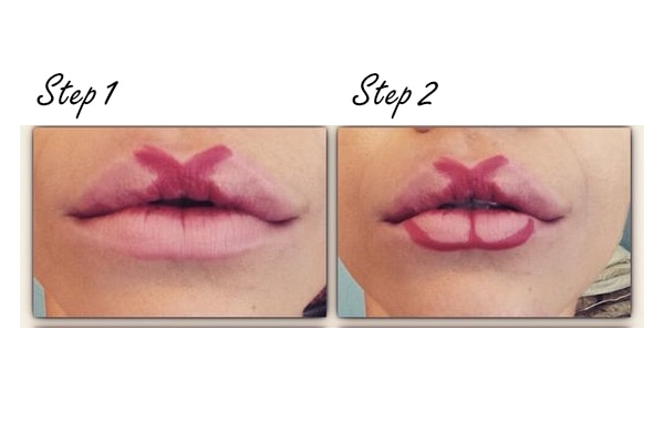 lip contouring