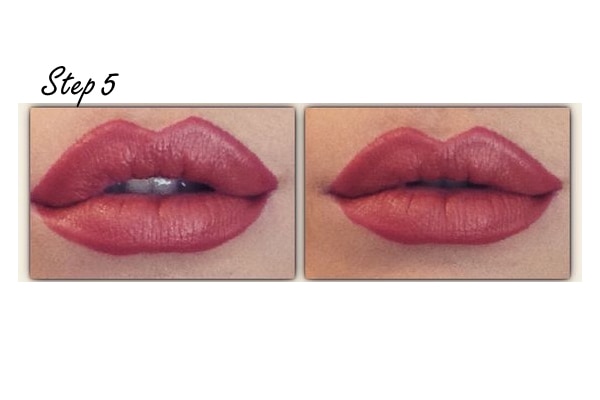 lip contouring