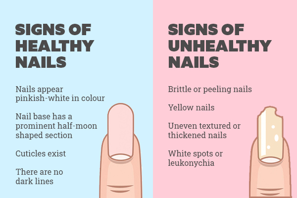 Nail Care Hacks EVERYONE Should Know! - YouTube