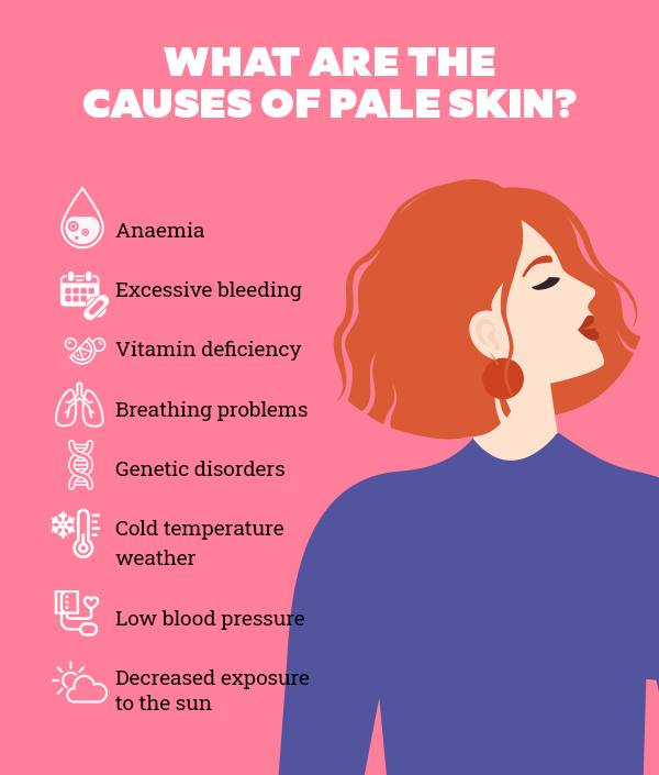 FAQs about pale skin