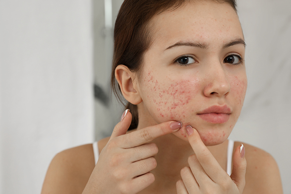 10. A simple regimen for sensitive skin