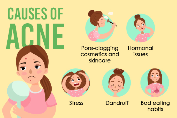 FAQs about skincare routine for acne-prone skin