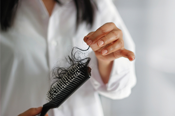 Different types of stress related hair loss