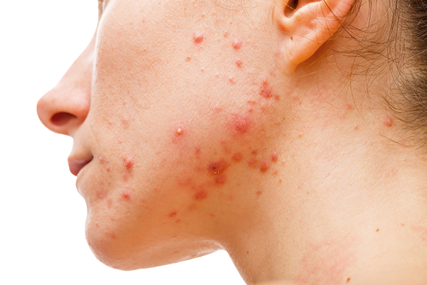Very dry skin may indicate thyroid issues