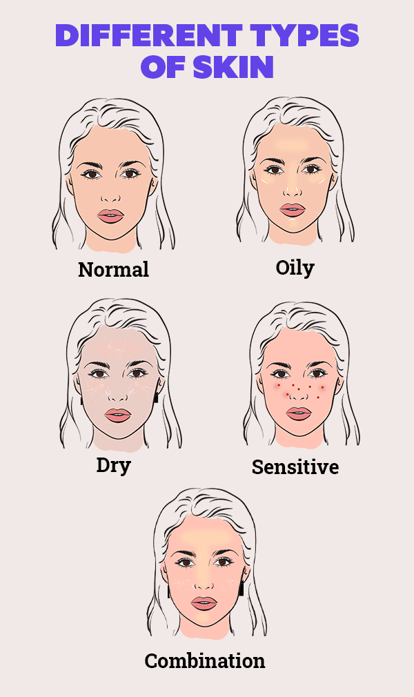 FAQs about types of skin